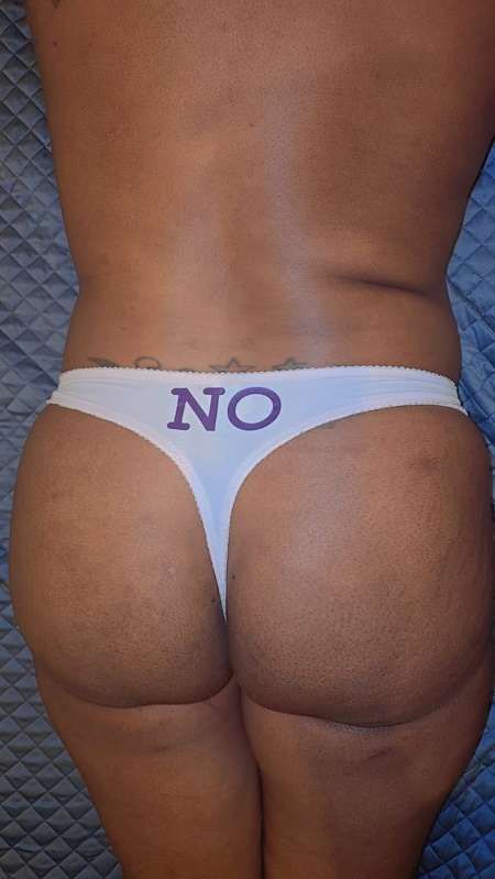 Naomie masseuse black